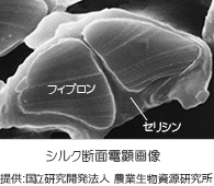 シルク断面電顕画像